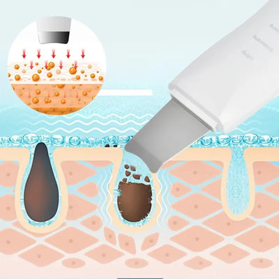 Blackhead Shovel Machine For Facial Skin Scrubber Lifting Moisturizing & Cleansing Skin Dirt Machine - With Premium Quality