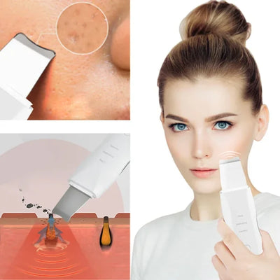 Blackhead Shovel Machine For Facial Skin Scrubber Lifting Moisturizing & Cleansing Skin Dirt Machine - With Premium Quality