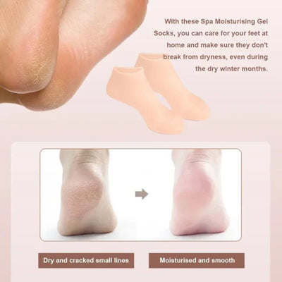 Silicone Moisturizing Gel Socks & Gloves Pack (64g) | Deep Repair for Dry Hands & Feet | Winter Care Deal