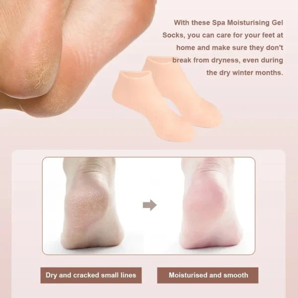 Silicone Moisturizing Gel Socks & Gloves Pack (64g) | Deep Repair for Dry Hands & Feet | Winter Care Deal